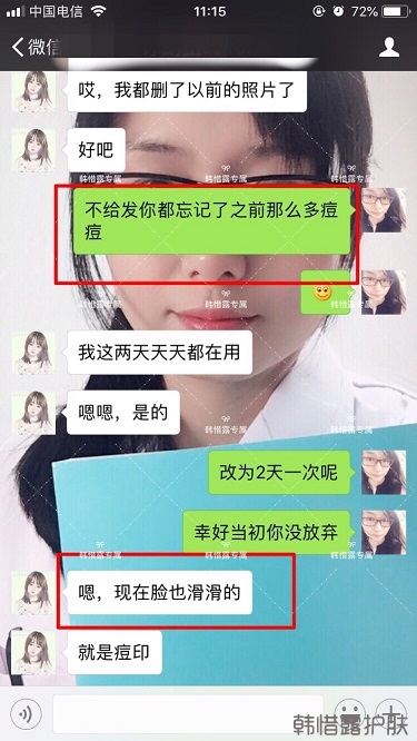 膿包痘祛痘效果，擁有干凈的臉不等待！