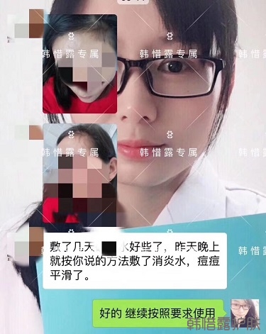 什么產品祛痘效果好？有什么祛痘效果好的產品？