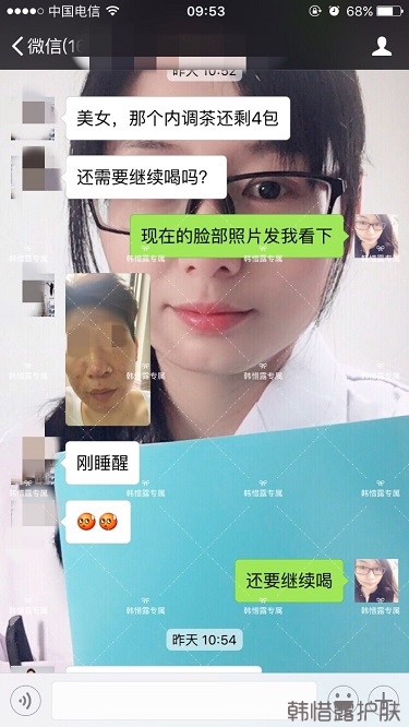 膿包結(jié)節(jié)發(fā)硬痘痘全消了，帥哥開心的來(lái)反饋了！