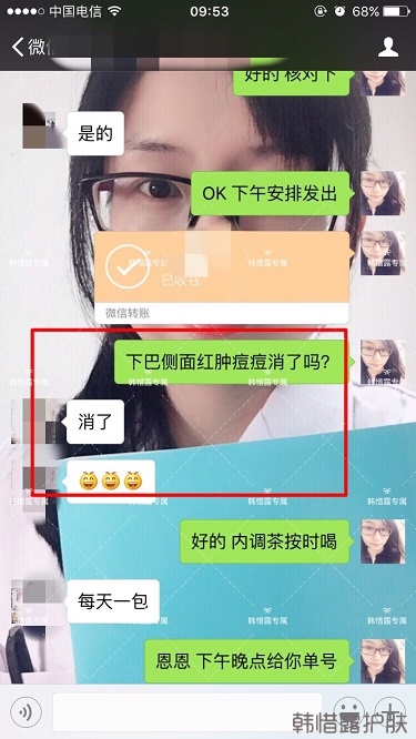 膿包結(jié)節(jié)發(fā)硬痘痘全消了，帥哥開心的來(lái)反饋了！