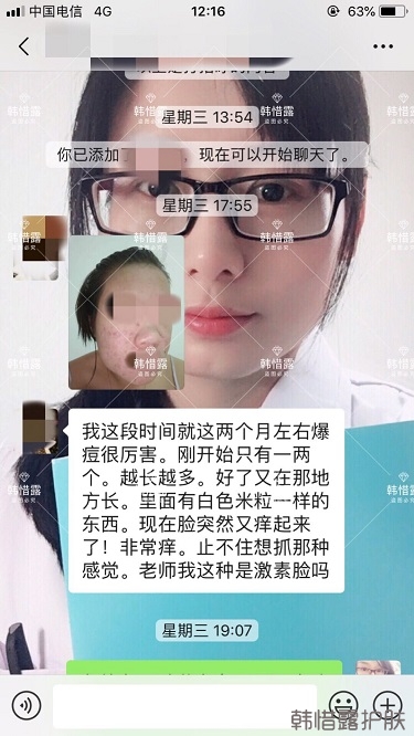 敏感粉刺長痘皮膚發(fā)炎一招解決！祛痘有辦法