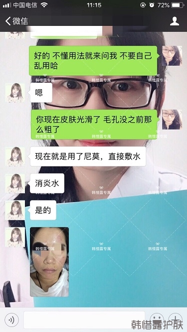 膿包痘祛痘效果，擁有干凈的臉不等待！