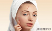 額頭長(zhǎng)痘痘怎么調(diào)理？露露教你額頭冒痘的日常護(hù)理方法