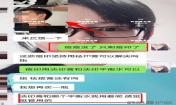 痘印怎么去？痘印調理案例，痘印淡化了